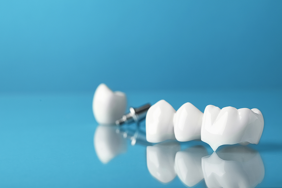 Restore Your Smile with Crowns and Bridges in New York, NY